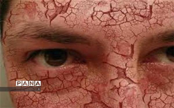 7 نکته جالب درباره پوست 7 نکته جالب درباره پوست